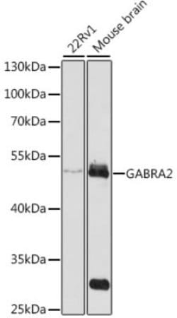 HIV-1 Rev binding protein (HRB) Rabbit anti-Human, Mouse, Polyclonal, Novus